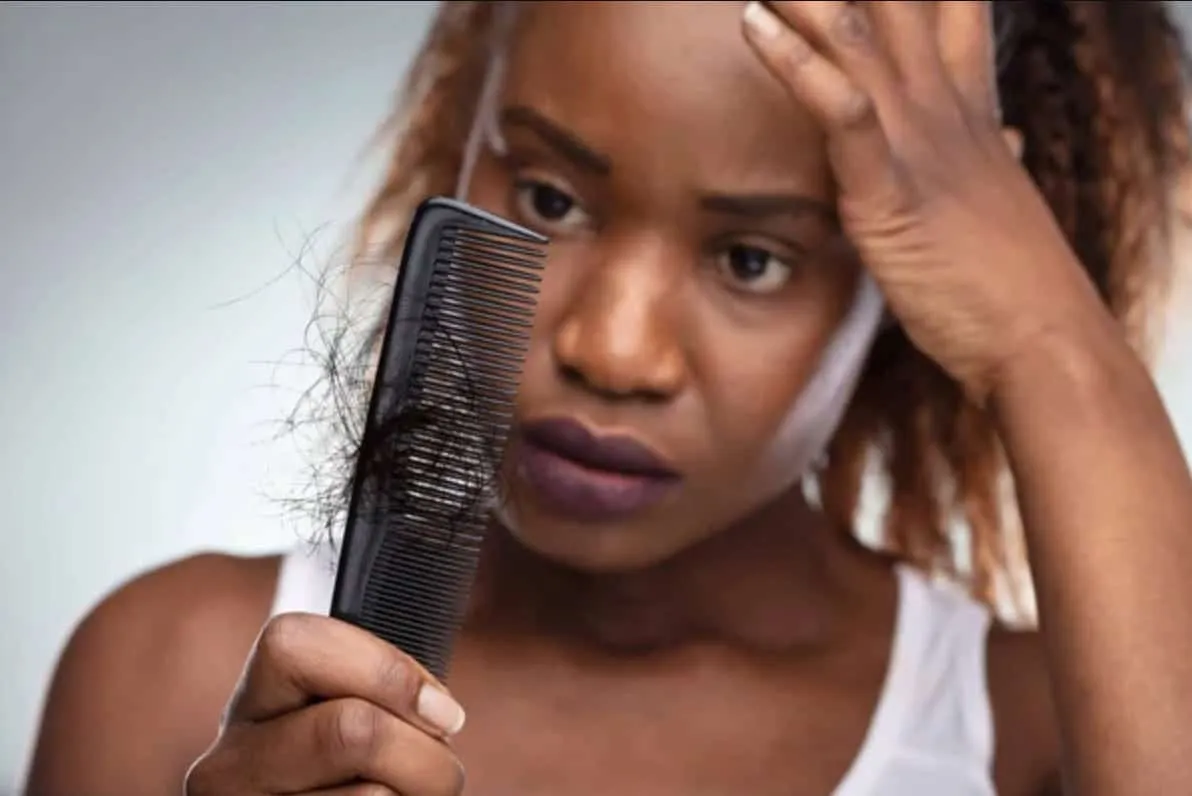 PRP hair treatment in Kumasi
